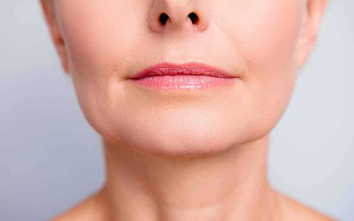 Le liplift : La chirurgie esthétique pour les lèvres | Dr Natalie ...